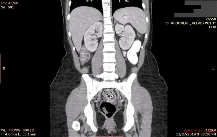 超10亿张患者医学图像被泄漏 但始终没引起医疗机构重视