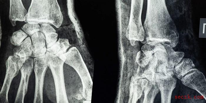 法国外科医生将患者X光片作为NFT销售 但未获得当事人同意